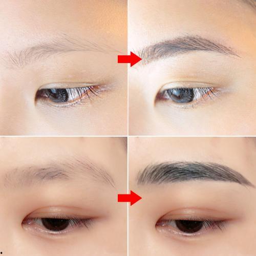 种植眉毛技术成熟吗视频,视频深度解析